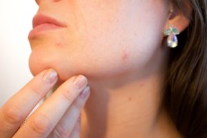 Skin Conditioning And Healing